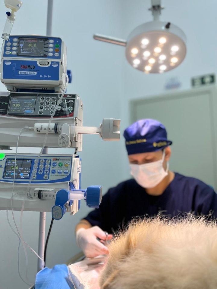 Três bombas de infusão empilhadas em modo TCI durante uma cirurgia